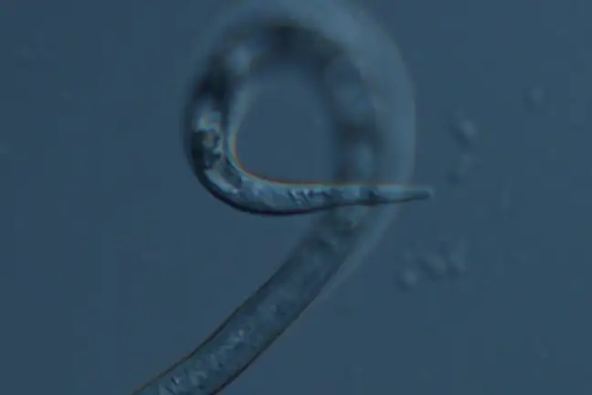 Pests Root Knot Nematode Juvenile Dept Agric WA